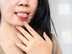 10 Cara Mengobati Sariawan di Rumah dengan Mudah