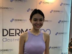 Amanda Manopo Ogah Oplas, Masih Sayang Duit