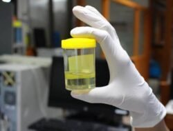 SAPA Desak Tes Urine Ketua dan Anggota DPRK Bireuen